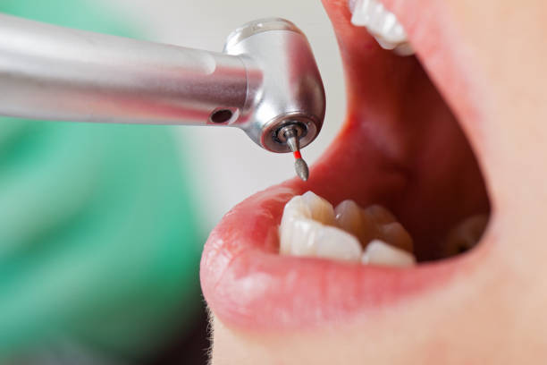 Best Urgent Care for Lost Fillings or Crowns in Salida Del Sol Estates, TX